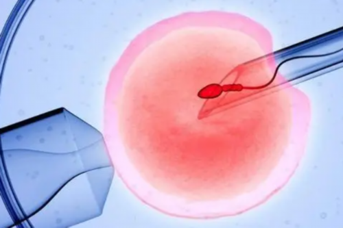 宁波三代供卵试管流程与助孕机构选择指南