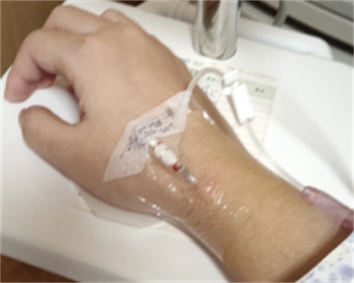 三代试管选男孩成功率对比与费用解析