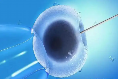 孕期胎心监测常见问题与辅助生殖选择指南