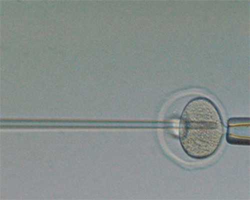 深圳私立医院试管助孕费用是否昂贵？