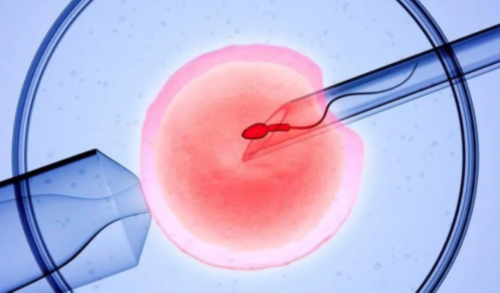 羊水穿刺风险解析与助孕选择指南
