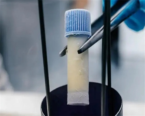 助孕价格与代生男孩解析：月经杯使用与试管流程