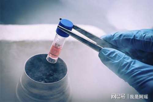 四维彩超一次过与胎儿性别无关，科学解读助孕知识