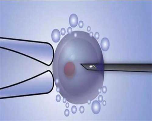 借卵试管费用解析与实验室试管优势，助孕选择指南