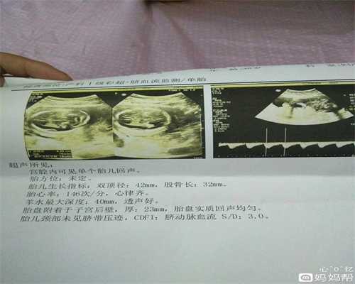 上海代孕怎么样_试管婴儿小腿麻胀怎么回事