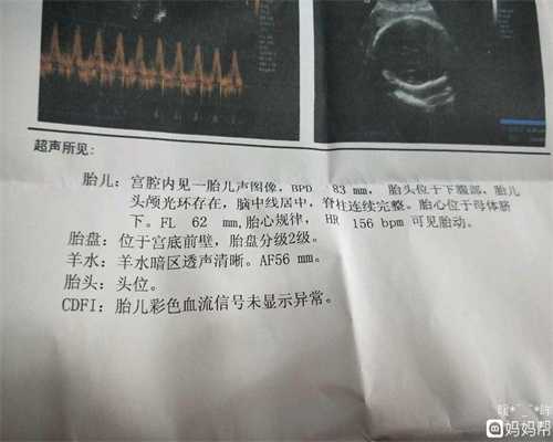 上海代孕包男孩_备孕期可以运动减肥吗