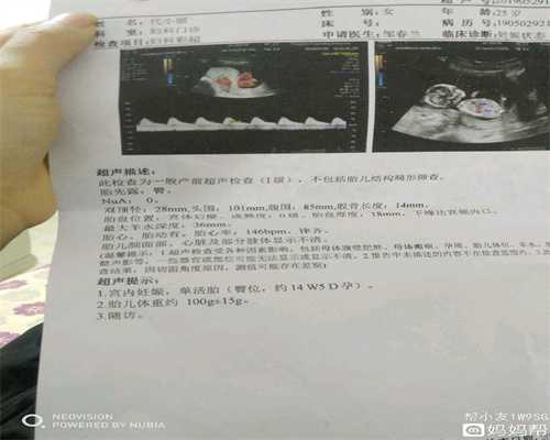 上海代孕公司_44岁受孕几率只有5%吗