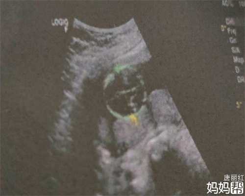 上海代孕医院_80年代怀孕病历_代怀孕是犯法吗