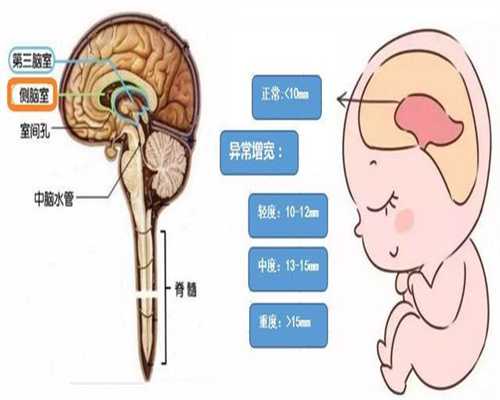 上海代孕付款方式_孕妇饮食禁忌 9种食物碰不得