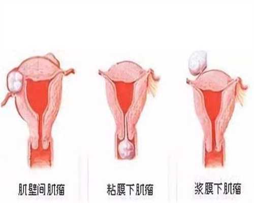 代孕网成功率高吗-代孕有哪些准备-胎儿绕颈两周纠正姿势