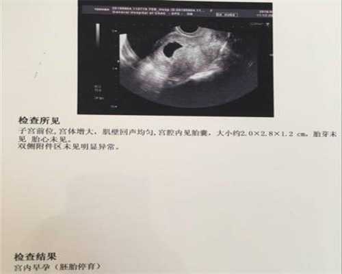 上海代孕微信_代孕费用专业正规_2020年可以代孕