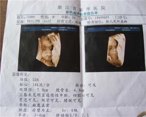 上海代孕在线咨询_代孕咨询电话_代孕的价格是多