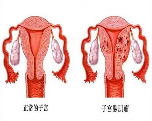上海南方代孕-代孕医院好不好_试管婴儿多少钱，农村做试管可得3万补助？