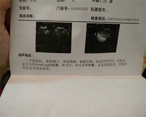 代孕百度贴吧-上海找个女人代孕需要多钱_北京试管婴儿排名医院哪家好
