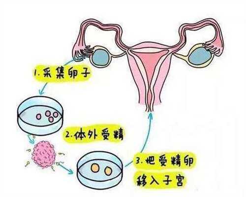 上海中国哪里有代孕公司-代孕生殖中心哪家好_泌乳素高对美国试管胚胎着床有