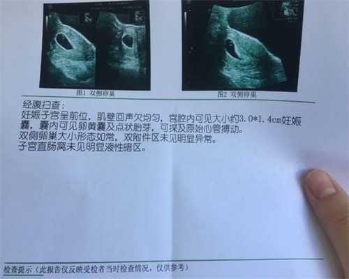 代孕最靠谱的机构-上海权威代孕医院排名_柴静专访剑桥大学校长（视频+文字）